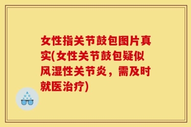 女性指关节鼓包图片真实(女性关节鼓包疑似风湿性关节炎，需及时就医治疗)
