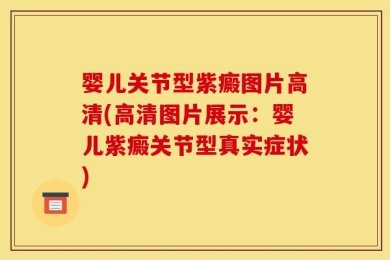 婴儿关节型紫癜图片高清(高清图片展示：婴儿紫癜关节型真实症状)