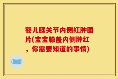 婴儿膝关节内侧红肿图片(宝宝膝盖内侧肿红，你需要知道的事情)