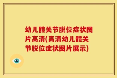 幼儿髋关节脱位症状图片高清(高清幼儿髋关节脱位症状图片展示)