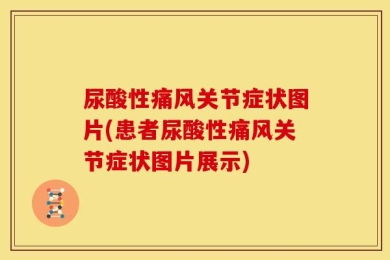 尿酸性痛风关节症状图片(患者尿酸性痛风关节症状图片展示)