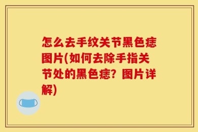 怎么去手纹关节黑色痣图片(如何去除手指关节处的黑色痣？图片详解)
