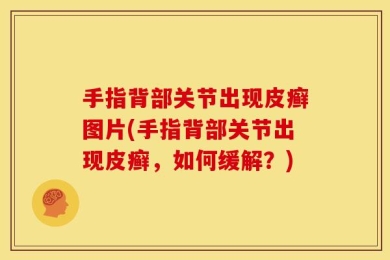 手指背部关节出现皮癣图片(手指背部关节出现皮癣，如何缓解？)