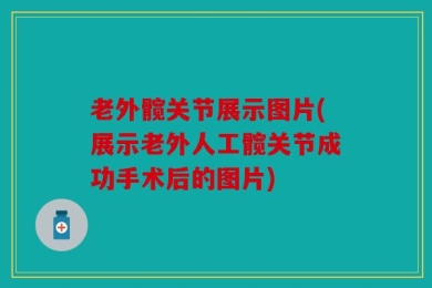 老外髋关节展示图片(展示老外人工髋关节成功手术后的图片)