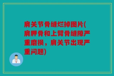 肩关节骨缝烂掉图片(肩胛骨和上臂骨缝隙严重磨损，肩关节出现严重问题)