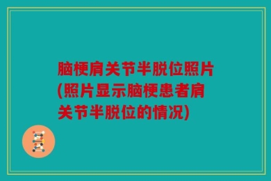 脑梗肩关节半脱位照片(照片显示脑梗患者肩关节半脱位的情况)
