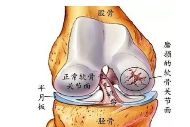 健力多氨糖软骨素钙生产地在哪儿？属于正规产品吗？