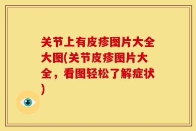 关节上有皮疹图片大全大图(关节皮疹图片大全，看图轻松了解症状)