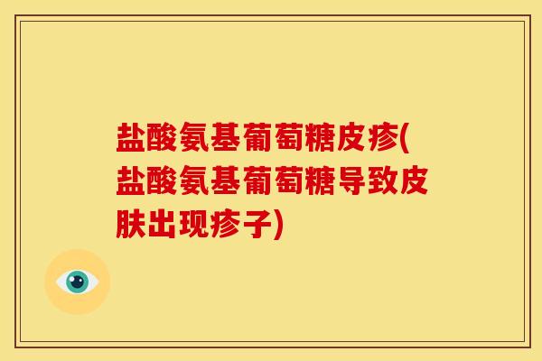 盐酸氨基葡萄糖皮疹(盐酸氨基葡萄糖导致出现疹子) 盐酸氨基葡萄糖皮疹(盐酸氨基葡萄糖导致出现疹子)