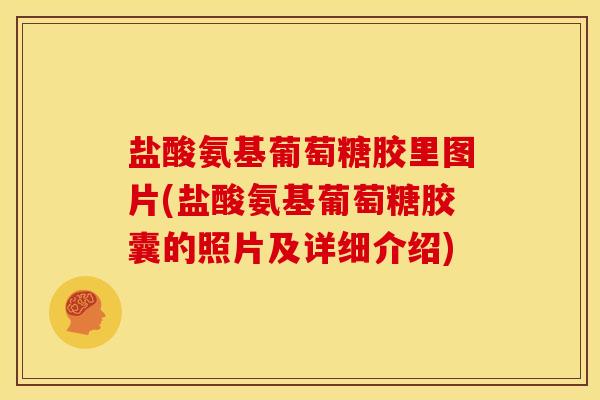 盐酸氨基葡萄糖胶里图片(盐酸氨基葡萄糖胶囊的照片及详细介绍) 盐酸氨基葡萄糖胶里图片(盐酸氨基葡萄糖胶囊的照片及详细介绍)