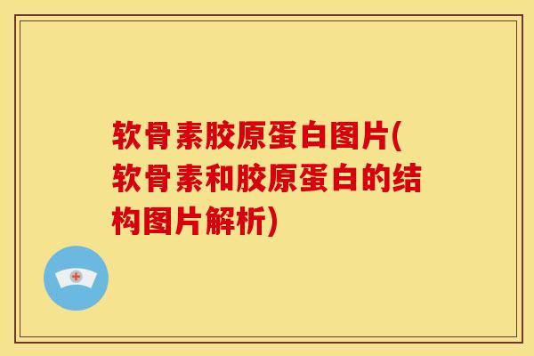 软骨素胶原蛋白图片(软骨素和胶原蛋白的结构图片解析) 软骨素胶原蛋白图片(软骨素和胶原蛋白的结构图片解析)