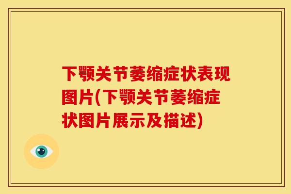 下颚关节萎缩症状表现图片(下颚关节萎缩症状图片展示及描述) 下颚关节萎缩症状表现图片(下颚关节萎缩症状图片展示及描述)