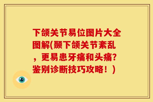 下颌关节易位图片大全图解(颞下颌关节紊乱,更易患牙痛和头痛?鉴别诊断技巧攻略!) 下颌关节易位图片大全图解(颞下颌关节紊乱,更易患牙痛和头痛?鉴别诊断技巧攻略!)