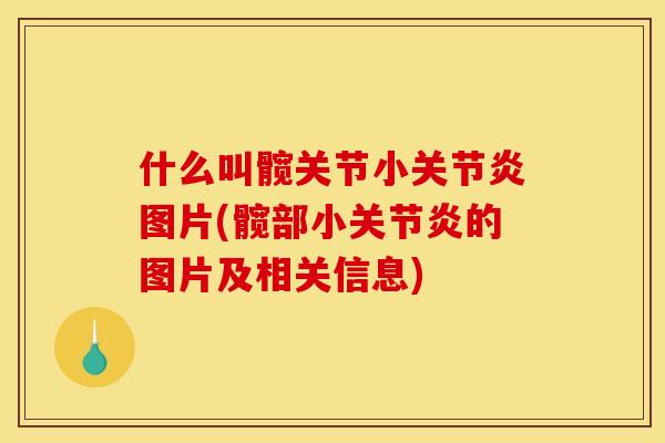 什么叫髋关节小图片(髋部小的图片及相关信息)