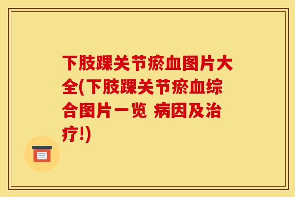 下肢踝关节瘀图片大全(下肢踝关节瘀综合图片一览 因及!) 下肢踝关节瘀图片大全(下肢踝关节瘀综合图片一览 因及!)