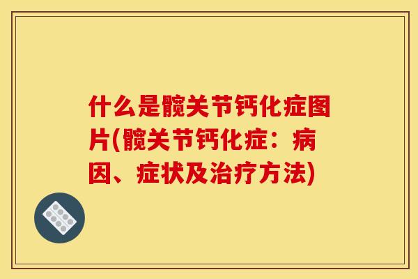 什么是髋关节钙化症图片(髋关节钙化症:因、症状及方法) 什么是髋关节钙化症图片(髋关节钙化症:因、症状及方法)