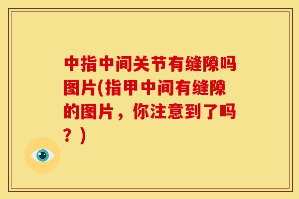 中指中间关节有缝隙吗图片(指甲中间有缝隙的图片,你注意到了吗?) 中指中间关节有缝隙吗图片(指甲中间有缝隙的图片,你注意到了吗?)