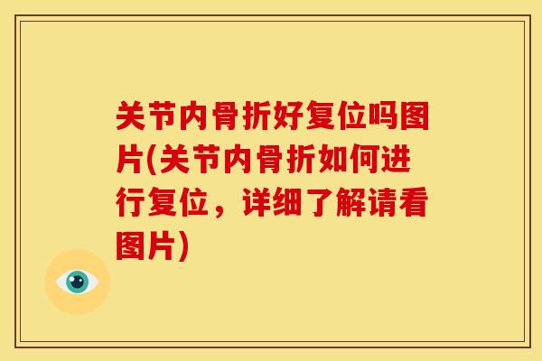 关节内好复位吗图片(关节内如何进行复位，详细了解请看图片)