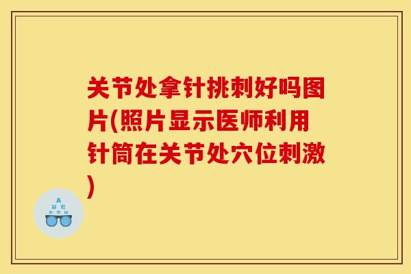 关节处拿针挑刺好吗图片(照片显示医师利用针筒在关节处穴位刺激) 关节处拿针挑刺好吗图片(照片显示医师利用针筒在关节处穴位刺激)