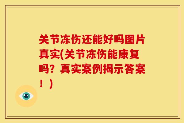 关节冻伤还能好吗图片真实(关节冻伤能康复吗?真实案例揭示答案!) 关节冻伤还能好吗图片真实(关节冻伤能康复吗?真实案例揭示答案!)