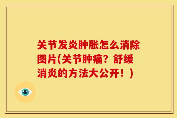 关节发炎怎么消除图片(关节肿痛?舒缓的方法大公开!) 关节发炎怎么消除图片(关节肿痛?舒缓的方法大公开!)