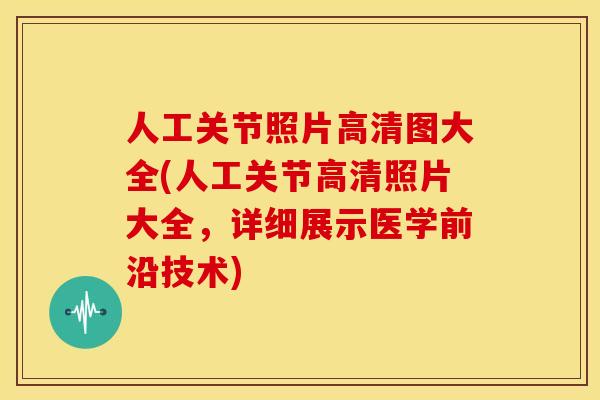 人工关节照片高清图大全(人工关节高清照片大全,详细展示医学前沿技术) 人工关节照片高清图大全(人工关节高清照片大全,详细展示医学前沿技术)