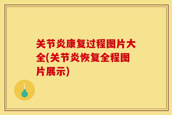 康复过程图片大全(恢复全程图片展示) 康复过程图片大全(恢复全程图片展示)