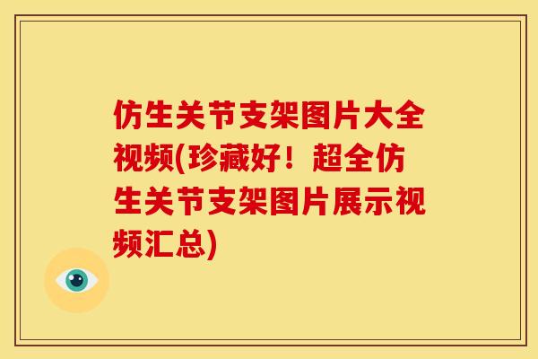 仿生关节支架图片大全视频(珍藏好!超全仿生关节支架图片展示视频汇总) 仿生关节支架图片大全视频(珍藏好!超全仿生关节支架图片展示视频汇总)