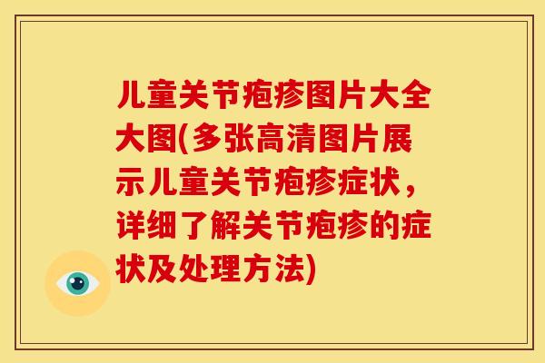 儿童关节疱疹图片大全大图(多张高清图片展示儿童关节疱疹症状，详细了解关节疱疹的症状及处理方法)