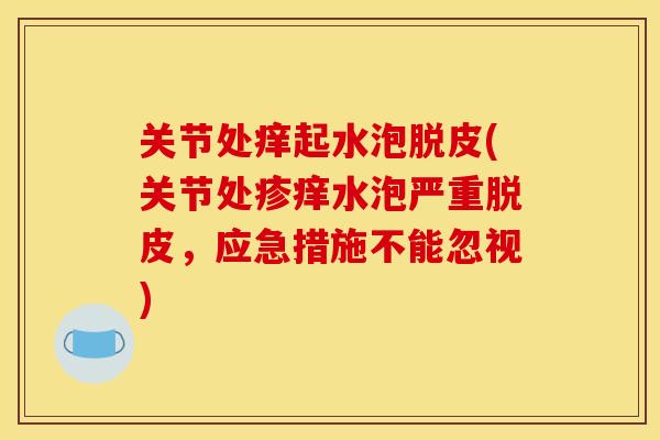 关节处痒起水泡脱皮(关节处疹痒水泡严重脱皮,应急措施不能忽视) 关节处痒起水泡脱皮(关节处疹痒水泡严重脱皮,应急措施不能忽视)