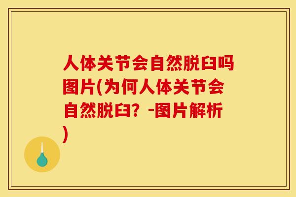 人体关节会自然脱臼吗图片(为何人体关节会自然脱臼?-图片解析) 人体关节会自然脱臼吗图片(为何人体关节会自然脱臼?-图片解析)