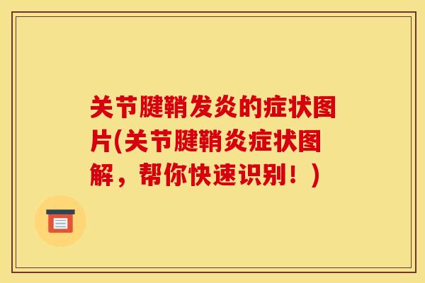 关节腱鞘发炎的症状图片(关节腱鞘状图解，帮你快速识别！)
