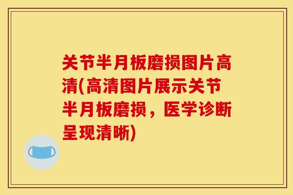 关节磨损图片高清(高清图片展示关节磨损,医学诊断呈现清晰) 关节磨损图片高清(高清图片展示关节磨损,医学诊断呈现清晰)