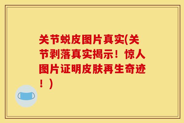 关节蜕皮图片真实(关节剥落真实揭示!惊人图片证明再生奇迹!) 关节蜕皮图片真实(关节剥落真实揭示!惊人图片证明再生奇迹!)