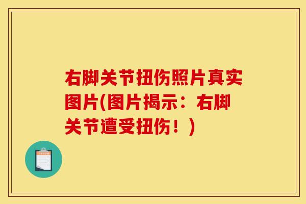 右脚关节扭伤照片真实图片(图片揭示:右脚关节遭受扭伤!) 右脚关节扭伤照片真实图片(图片揭示:右脚关节遭受扭伤!)
