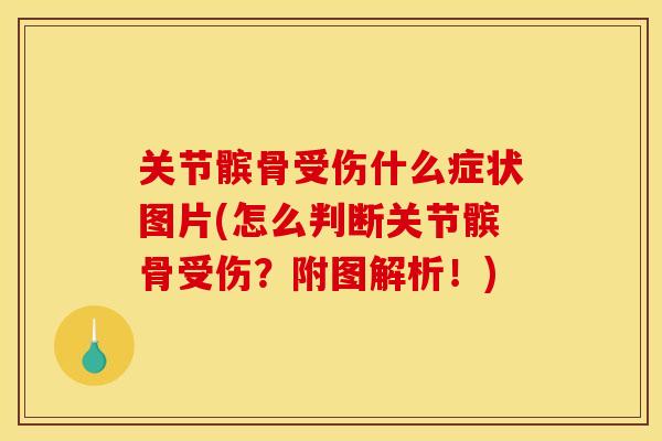 关节髌骨受伤什么症状图片(怎么判断关节髌骨受伤？附图解析！)
