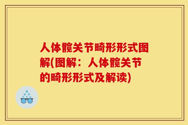 人体髋关节畸形形式图解(图解：人体髋关节的畸形形式及解读)