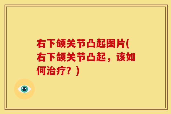 右下颌关节凸起图片(右下颌关节凸起,该如何?) 右下颌关节凸起图片(右下颌关节凸起,该如何?)