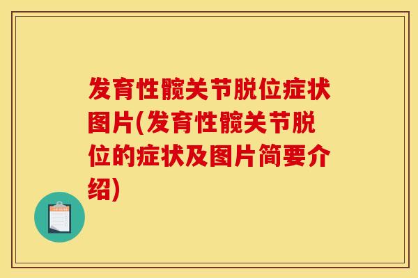 发育性髋关节脱位症状图片(发育性髋关节脱位的症状及图片简要介绍)