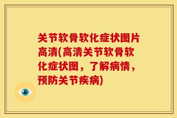 关节软骨软化症状图片高清(高清关节软骨软化症状图,了解情,关节) 关节软骨软化症状图片高清(高清关节软骨软化症状图,了解情,关节)