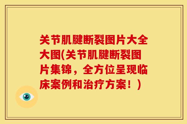 关节肌腱断裂图片大全大图(关节肌腱断裂图片集锦,全方位呈现临床案例和方案!) 关节肌腱断裂图片大全大图(关节肌腱断裂图片集锦,全方位呈现临床案例和方案!)