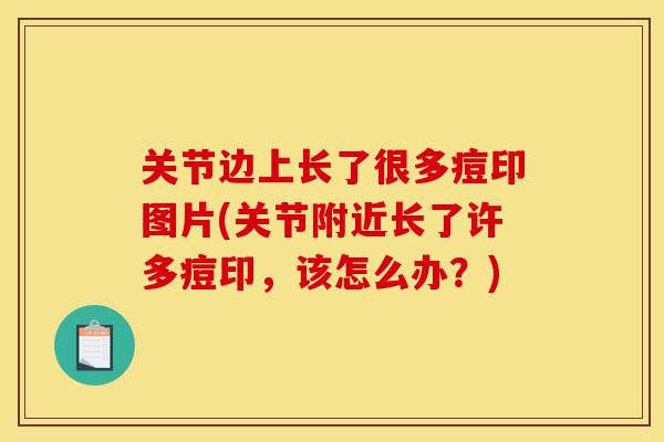 关节边上长了很多痘印图片(关节附近长了许多痘印，该怎么办？)