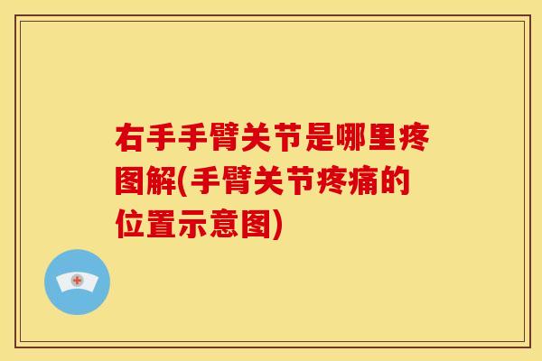 右手手臂关节是哪里疼图解(手臂关节的位置示意图) 右手手臂关节是哪里疼图解(手臂关节的位置示意图)