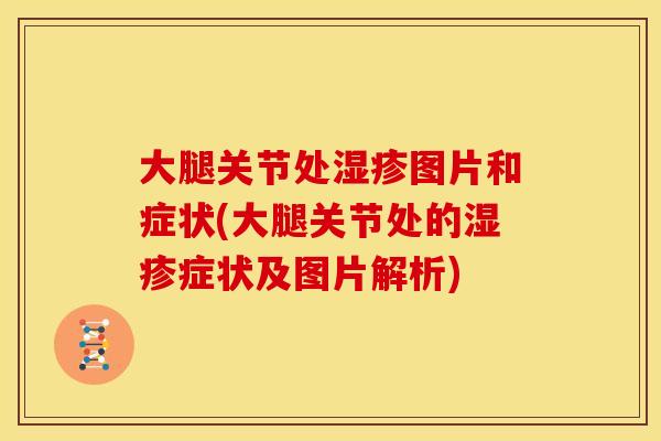 大腿关节处图片和症状(大腿关节处的症状及图片解析) 大腿关节处图片和症状(大腿关节处的症状及图片解析)