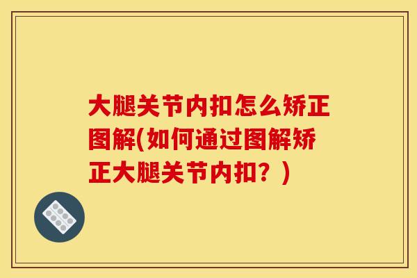 大腿关节内扣怎么矫正图解(如何通过图解矫正大腿关节内扣?) 大腿关节内扣怎么矫正图解(如何通过图解矫正大腿关节内扣?)