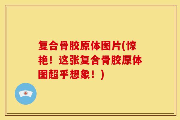 复合骨胶原体图片(惊艳！这张复合骨胶原体图超乎想象！)
