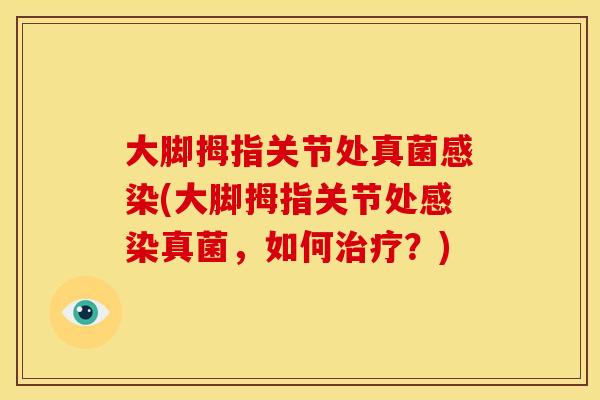 大脚拇指关节处真菌(大脚拇指关节处真菌，如何？)