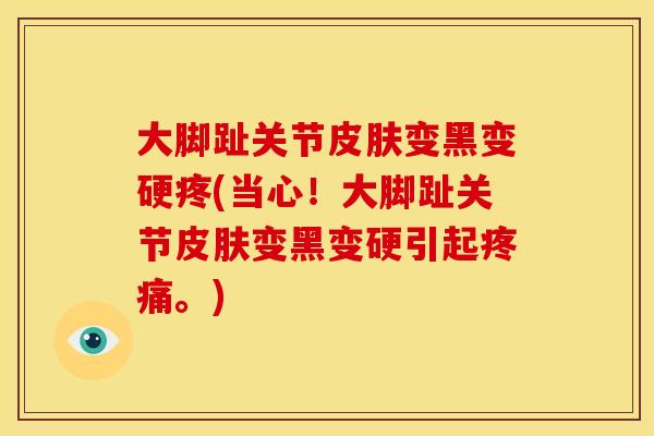 大脚趾关节变黑变硬疼(当心！大脚趾关节变黑变硬引起。)
