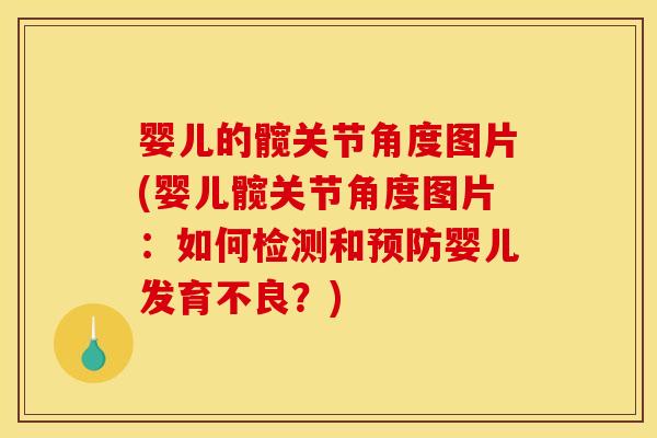 婴儿的髋关节角度图片(婴儿髋关节角度图片：如何检测和婴儿发育不良？)