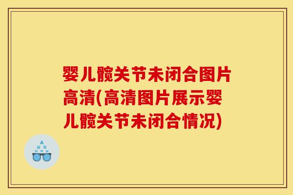 婴儿髋关节未闭合图片高清(高清图片展示婴儿髋关节未闭合情况)